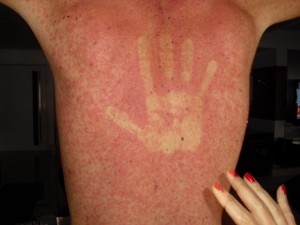 dengue por lenings.blogspot.com.br